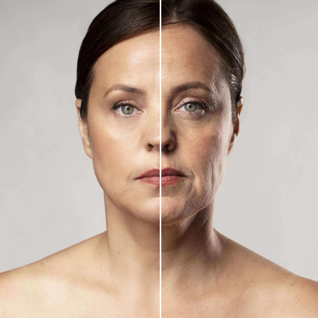 How Is Facelift Surgery Performed?